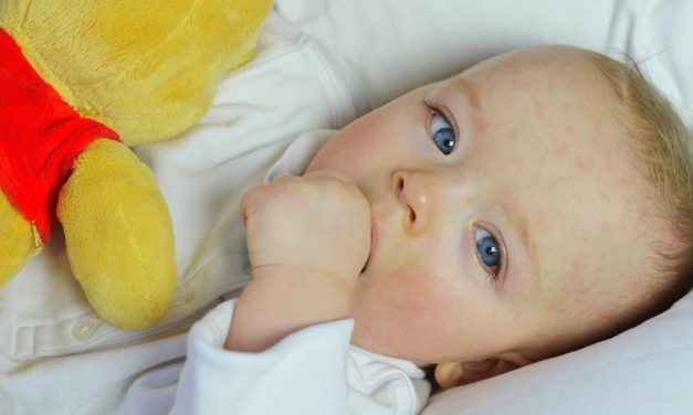 Ist das seltene Drei-Tage-Fieber gefährlich für eure Kids?