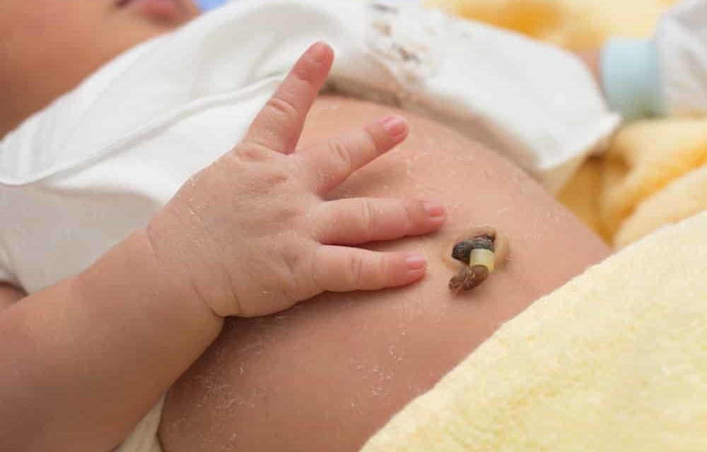 Nabelpflege bei Neugeborenen, so einfach geht es