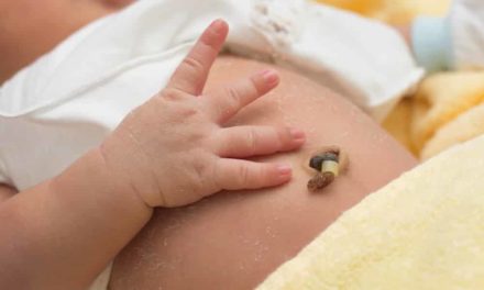 Nabelpflege bei Neugeborenen, so einfach geht es